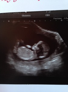 My 12 week scan